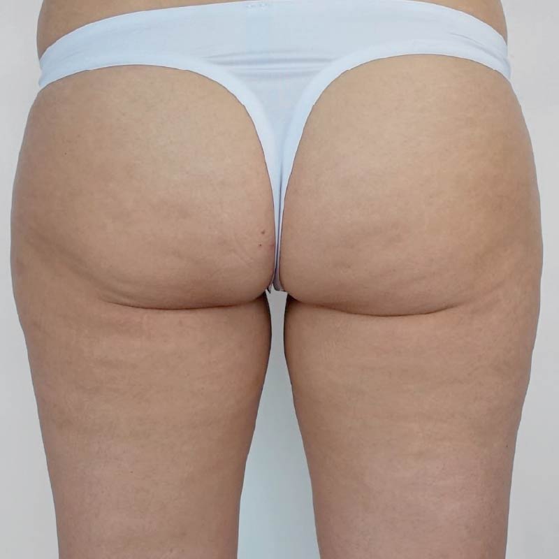 After image