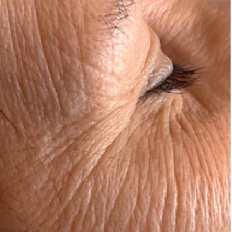 Before image